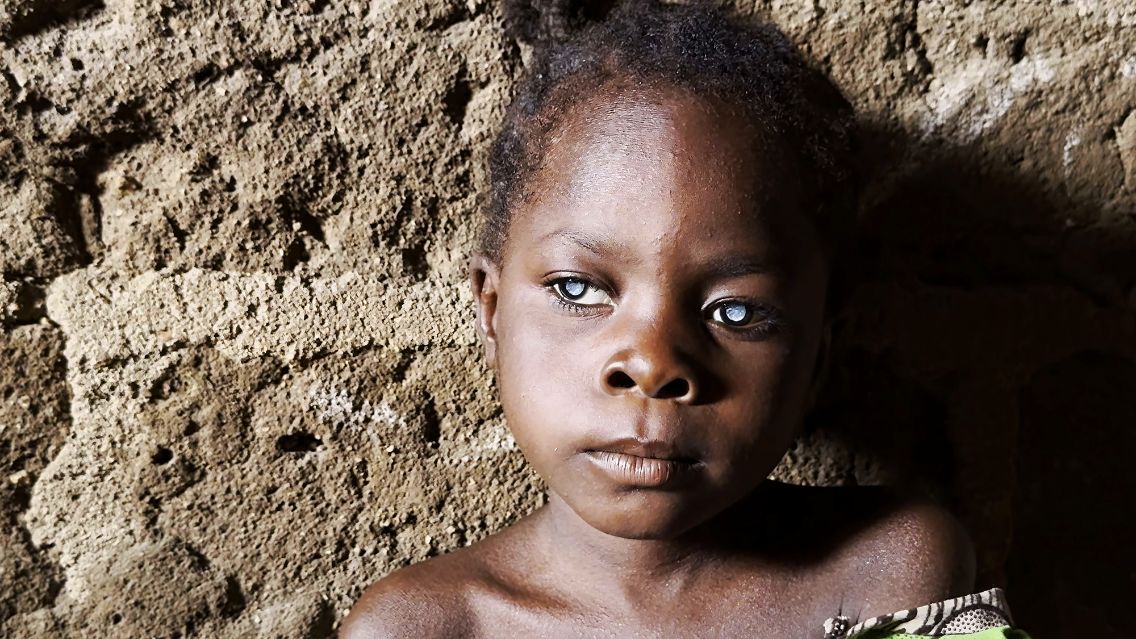 Ein kleines Mädchen mit weißen Pupillen sitzt an eine Mauer gelehnt.