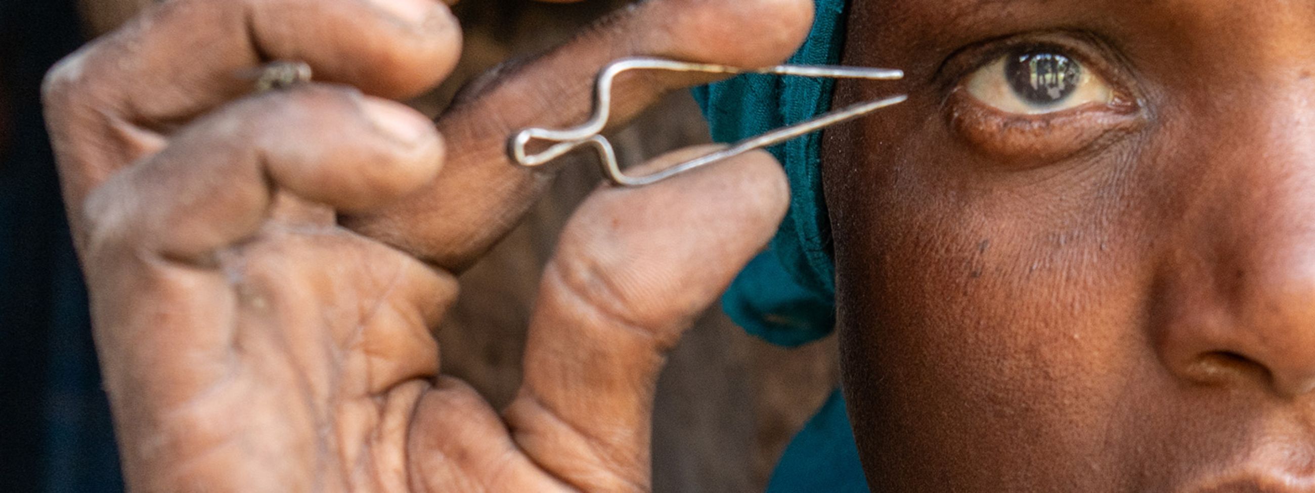 Eine Frau mit buntem Koptuch und geröteten Augen hält eine Pinzette an ihre Wimpern.