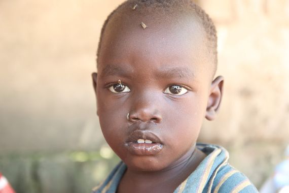 Porträt eines kleinen Jungen, auf dessen Stirn und Nase eine Fliege sitzt.