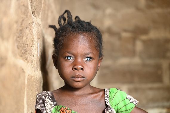 Ein etwa achtjähriges Mädchen steht vor einer gemauerten Zimmerwand. Das Kind hat auffallend weiße Pupillen.